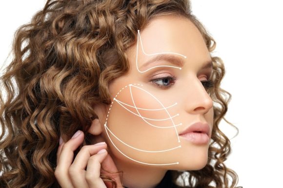 Fils crantés non résorbables Fils crantés non résorbables : Une solution révolutionnaire pour une peau raffermie et durable en chirurgie esthétique