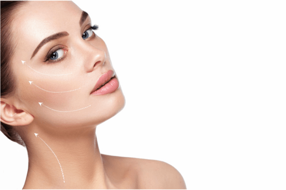 image Lifting médical aux fils crantés non résorbables ThreadLift
