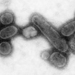 Virus H1N1