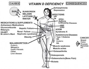 Déficience en vitamine D