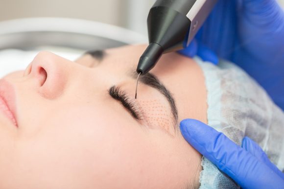 Plasma IQ Plasma IQ : La révolution non chirurgicale du rajeunissement cutané